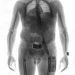 CLEARPASS Ci · Portable body scanner - Image 4