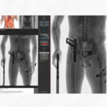 CONPASS SMART TR · Prisoners screening - Image 2